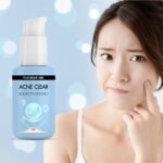 Acne Clear Solution Essence
