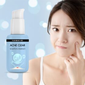 Acne Clear Solution Essence