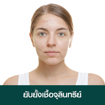 ยับยั้งเชื้อจุลินทรีย์ ยับยั้งเชื้อจุลินทรีย์