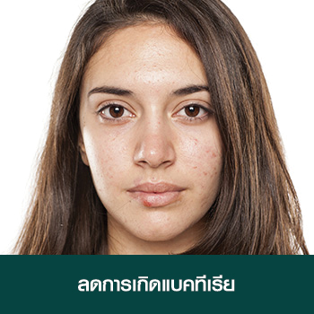 ลดการเกิดแบคทีเรีย